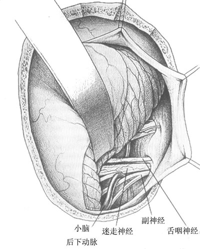 uYYBAFfxAuKAfzpHAAHs45rOFvE749_副本.jpg