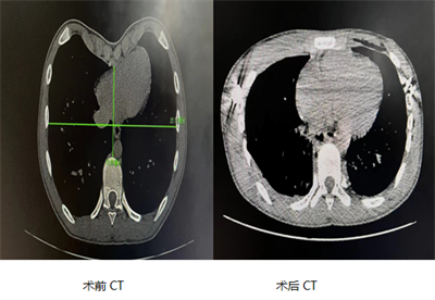 搜狗高速浏览器截图20240718110959.png